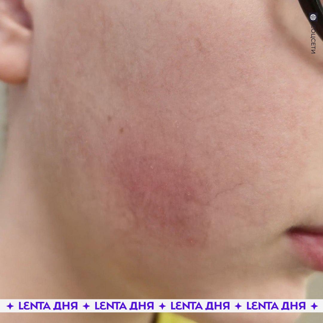 😳 Ребёнок попал в больницу из-за детского сока