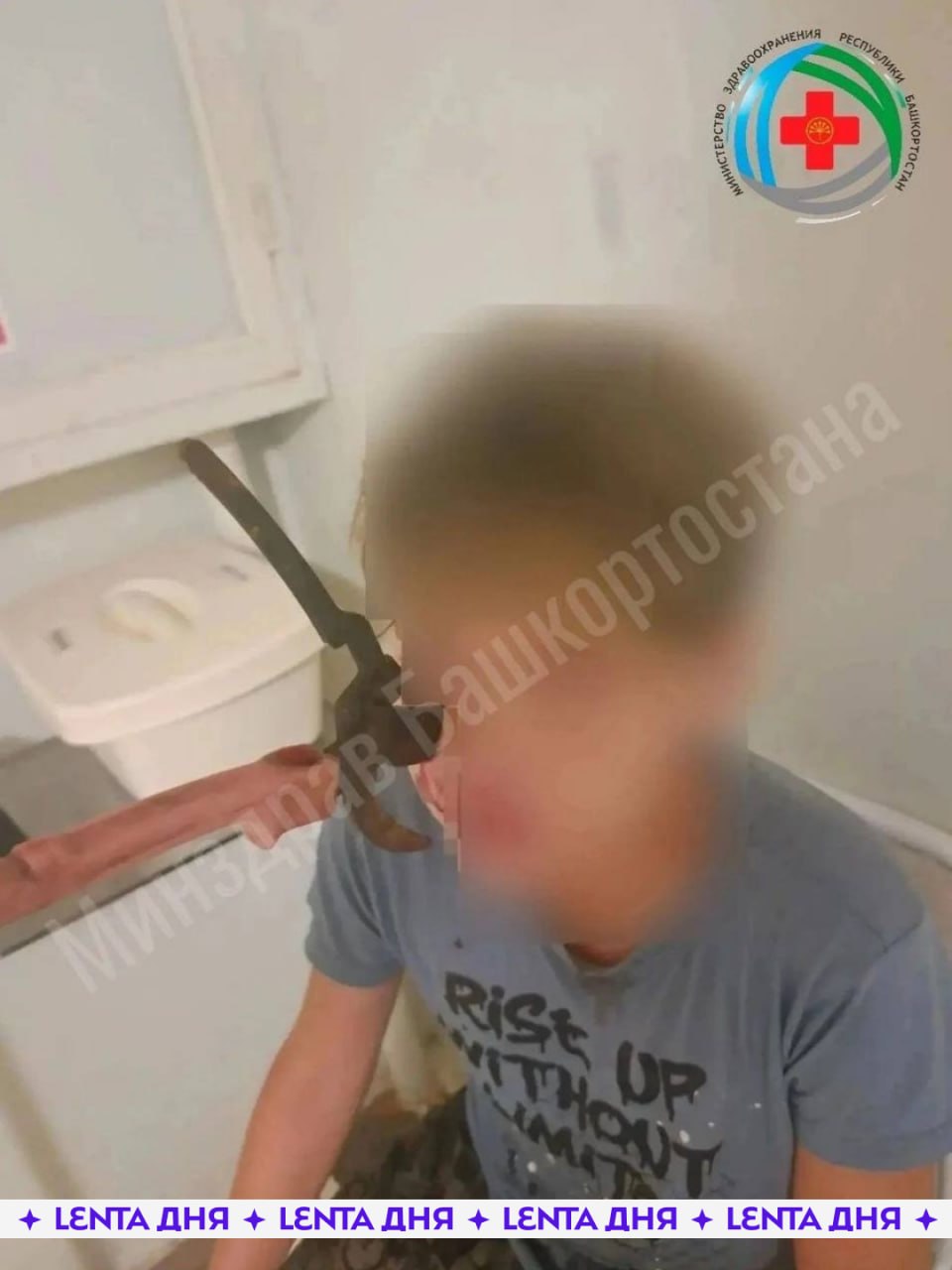 😨 Секатор вонзился в голову подростку и чуть не лишил его зрения